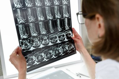 Omurga MR 'ının sonuçlarını inceleyen doktor. Sağlık ve sağlık sigortası kavramı