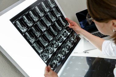 Omurga MR 'ının sonuçlarını inceleyen doktor. Sağlık ve sağlık sigortası kavramı