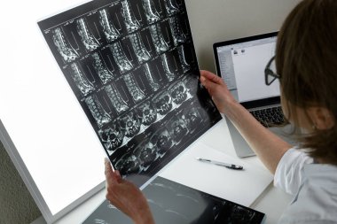 Omurga MR 'ının sonuçlarını inceleyen doktor. Sağlık ve sağlık sigortası kavramı