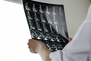 Omurga MR 'ının sonuçlarını inceleyen doktor. Sağlık ve sağlık sigortası kavramı