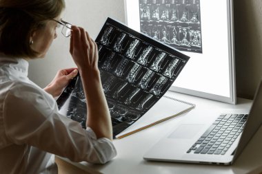Doctor examining the result of lower spine MRI . Health care and medical insurance concept
