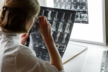 Doctor examining the result of lower spine MRI . Health care and medical insurance concept