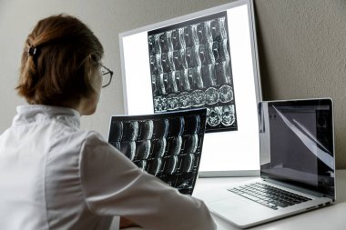 Doctor examining the result of cervical spine MRI . Health care and medical insurance concept