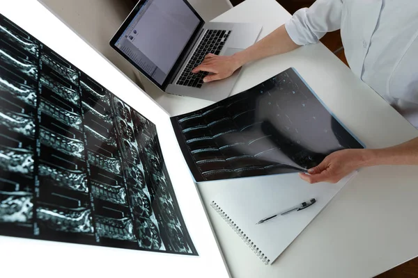 Médico Examinar Resultado Ressonância Magnética Coluna Média Conceito Cuidados Saúde — Fotografia de Stock