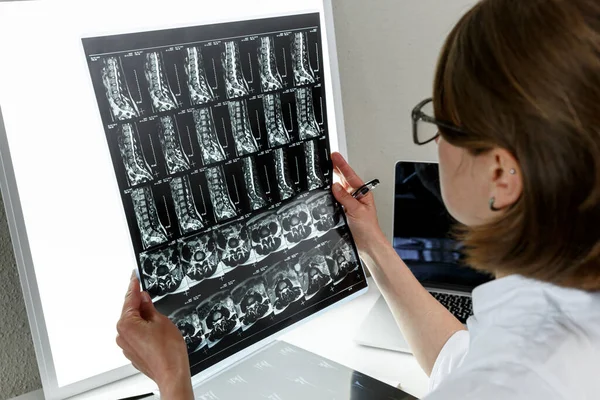 Doctor Examining Result Lower Spine Mri Health Care Medical Insurance — Stok fotoğraf