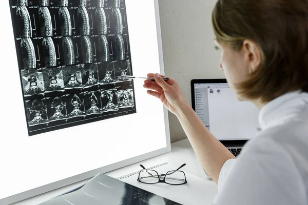 Doctor Examining Result Lower Spine Mri Health Care Medical Insurance — Stok fotoğraf