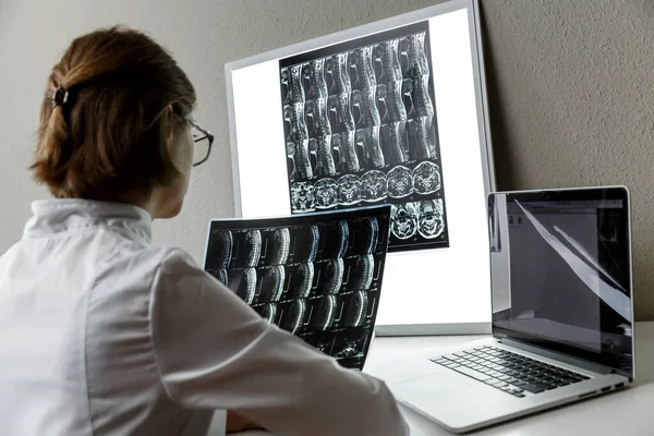 Doctor Examining Result Cervical Spine Mri Health Care Medical Insurance — Fotografia de Stock