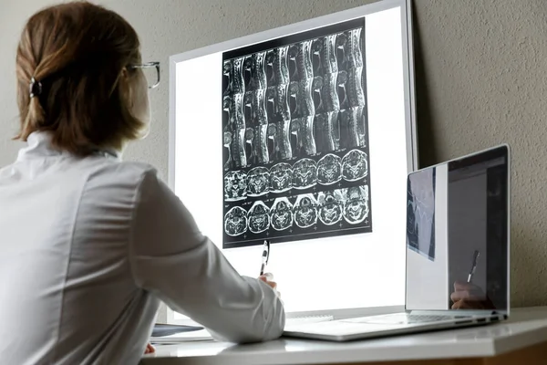 Médico Examinando Resultado Ressonância Magnética Coluna Cervical Conceito Cuidados Saúde — Fotografia de Stock