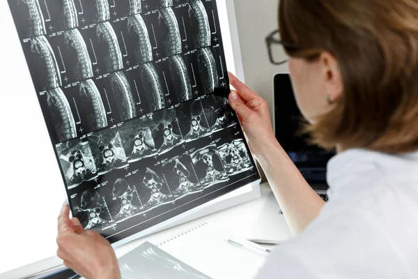 Doctor Examining Result Middle Spine Mri Health Care Medical Insurance — Stok fotoğraf