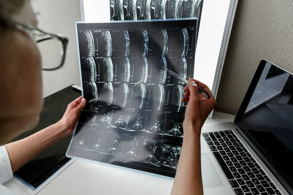 Doctor Examinando Resultado Resonancia Magnética Columna Media Concepto Atención Médica —  Fotos de Stock