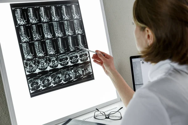 Doctor Examining Result Lower Spine Mri Health Care Medical Insurance — Stock Photo, Image