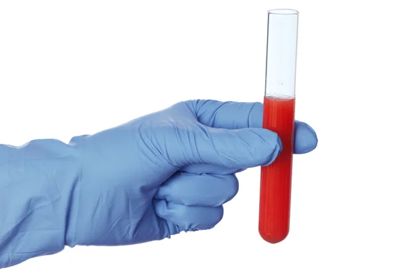 혈액 샘플을 — 스톡 사진