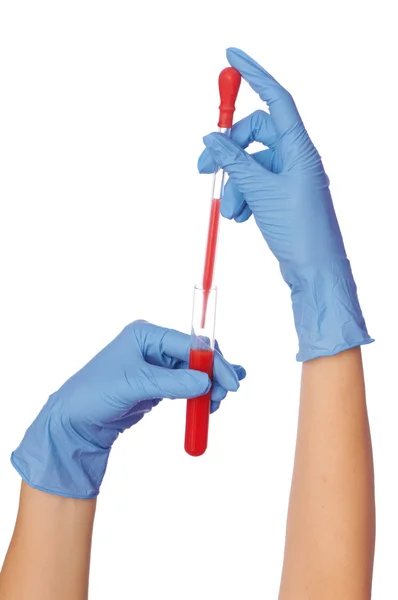 Blood test — Stock Photo, Image
