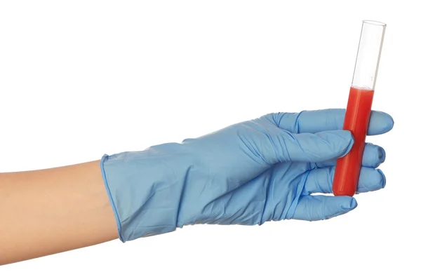 Sample of bloods — Stock Photo, Image