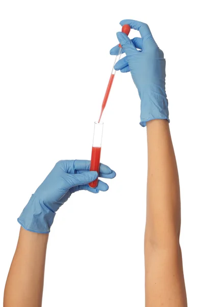 Sample of bloods — Stock Photo, Image