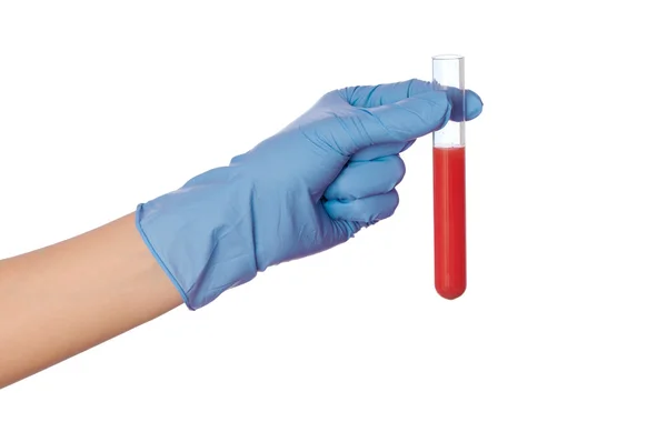 Blood for antidote — Stock Photo, Image