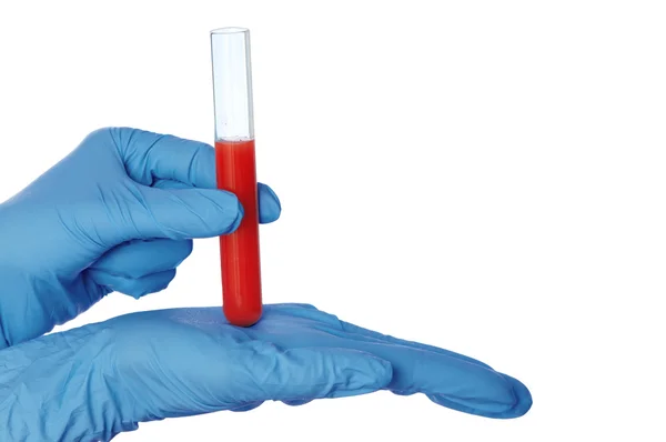 Sample of bloods — Stock Photo, Image