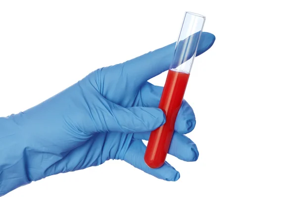 Sample of bloods — Stock Photo, Image