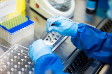 Coronavirus SARS-CoV-2 PCR testi 