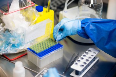 COVID-19 için teşhis testleri