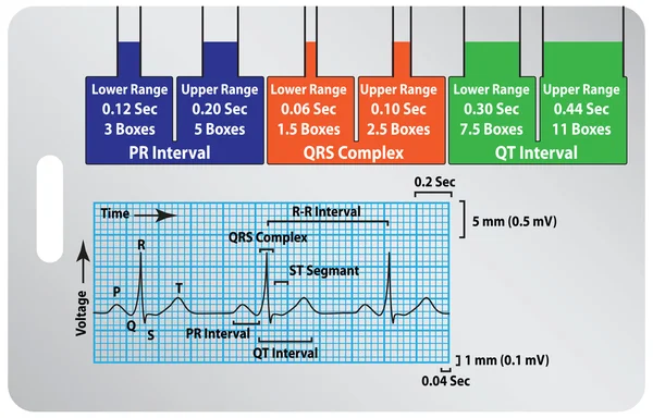 Guida ECG — Vettoriale Stock