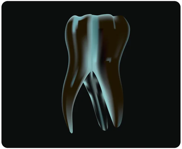 Röntgen des Zahnes — Stockvektor