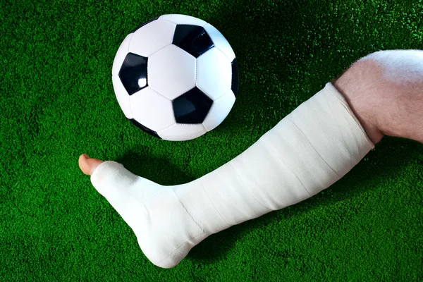 Broken leg — Stock Photo, Image