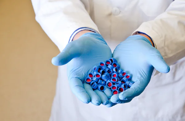 A mão dos cientistas segura tampas descartáveis para cromatografia — Fotografia de Stock