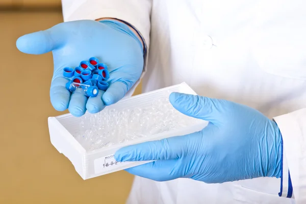 Scientists hand holds disposable caps for chromatography — Stock Photo, Image