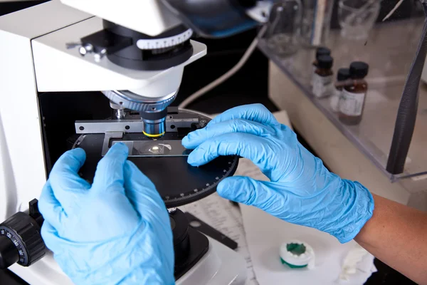 Επιστήμονας, εκμετάλλευση παγωμένος γυαλί φωτογραφικές διαφάνειες μικροσκοπίων — Φωτογραφία Αρχείου