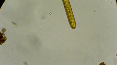 mikroskop altında canlı diatom yosun