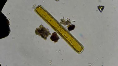 mikroskop altında canlı diatom yosun