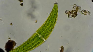 closterium yosun mikroskop altında