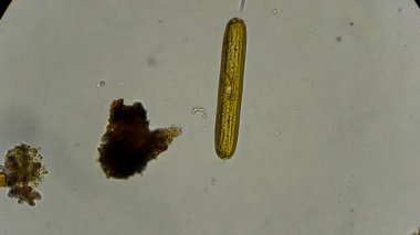 mikroskop altında canlı diatom yosun