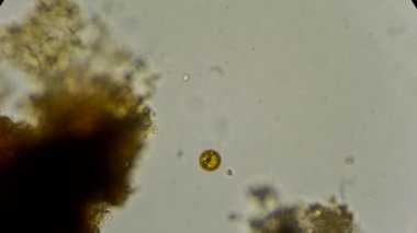 mikroskop altında canlı diatom yosun