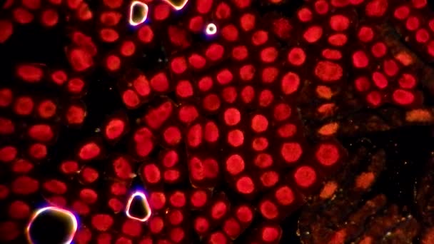 Live cancer cells under microscope — Stock Video