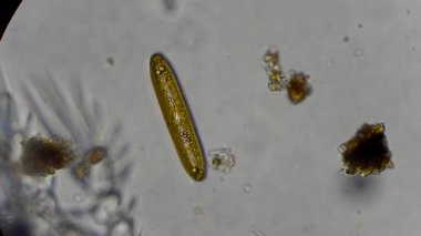 mikroskop altında diatom yosun