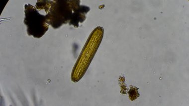 mikroskop altında diatom yosun