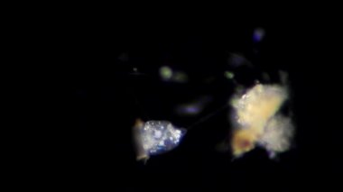 Vorticella mikroskop altında
