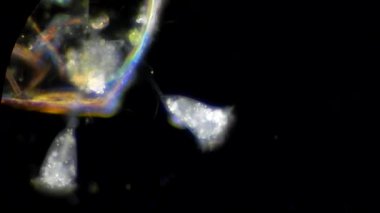 Vorticella mikroskop altında
