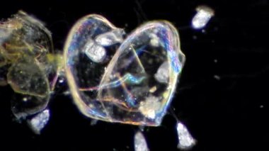 Vorticella mikroskop altında