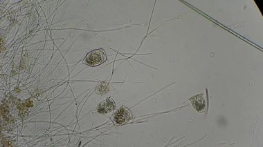 Vorticella mikroskop altında
