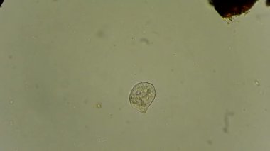 Vorticella mikroskop altında