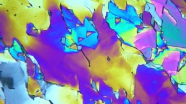 vitamin b mikroskop altında crystalls