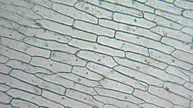 soğan hücrelerin mikroskop altında büyük çekirdeği ile