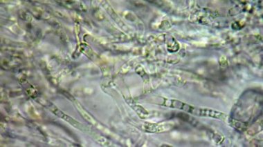 fangi (mantar) hücrelerin mikroskop altında