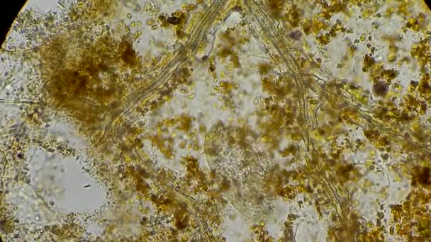 Infusoria bajo el microscopio — Vídeos de Stock