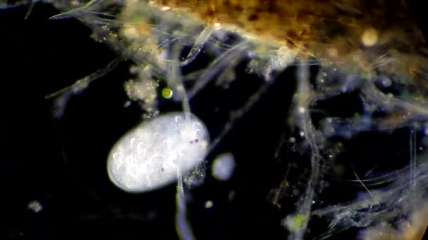 Infusoria bajo el microscopio — Vídeo de stock