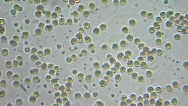 Goutte de mon sang au microscope 