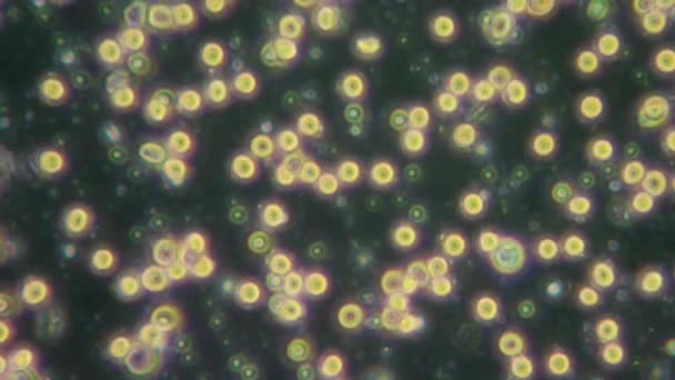 한 방울의 현미경 내 피 — 비디오